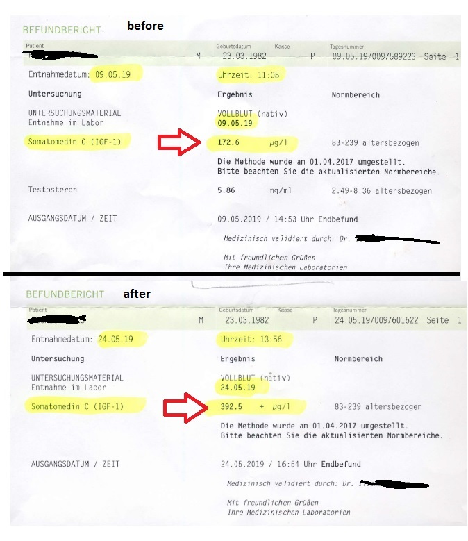 Picture: My IGF-1 results - before and after 2 weeks of godtropin