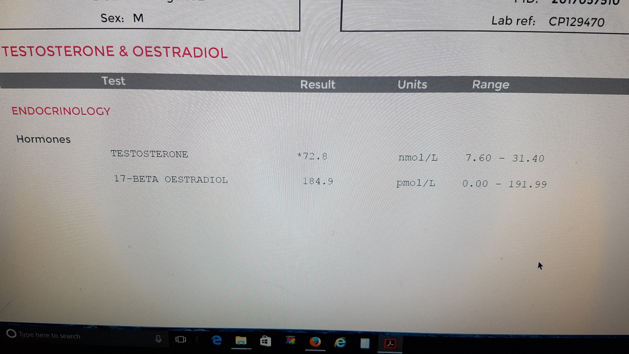 picture-lab-test-for-norma-test-enanthate